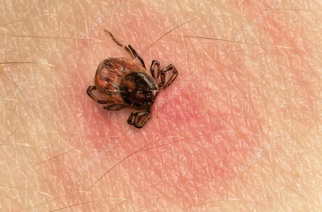 prévenir les risques de piqûres de tiques et les maladies associées !