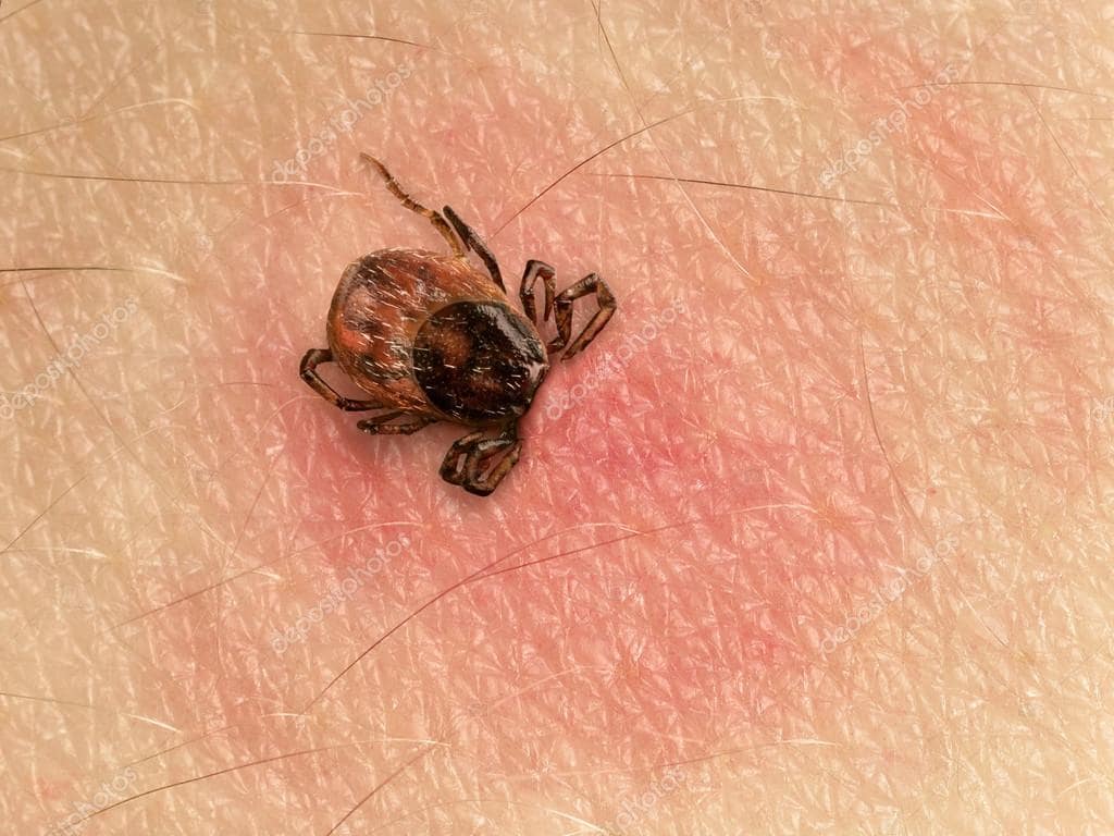 prévenir les risques de piqûres de tiques et les maladies associées !